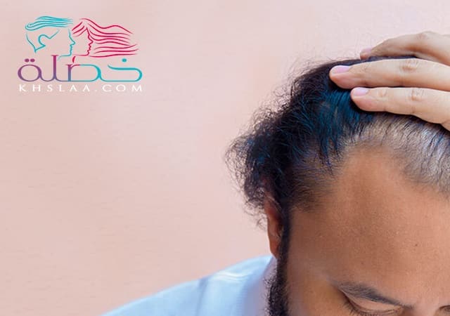 طرق حماية الشعر من التساقط في فصل الصيف للرجال